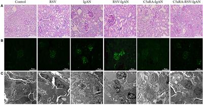 Corrigendum: Respiratory Syncytial Virus Exacerbates Kidney Damages in IgA Nephropathy Mice via the C5a-C5aR1 Axis Orchestrating Th17 Cell Responses